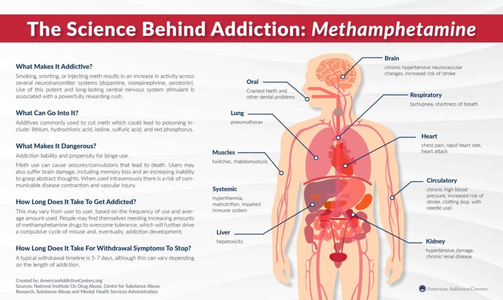 Best Alcohol Detox San Diego Explains Methamphetamine